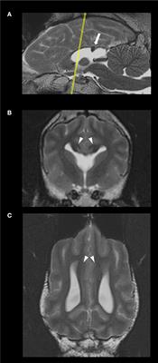 Presence of Probst Bundles Indicate White Matter Remodeling in a Dog With Corpus Callosum Hypoplasia and Dysplasia